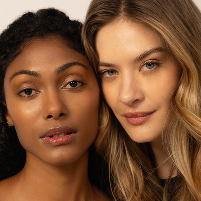 Saiba quais alimentos podem aumentar sua acne