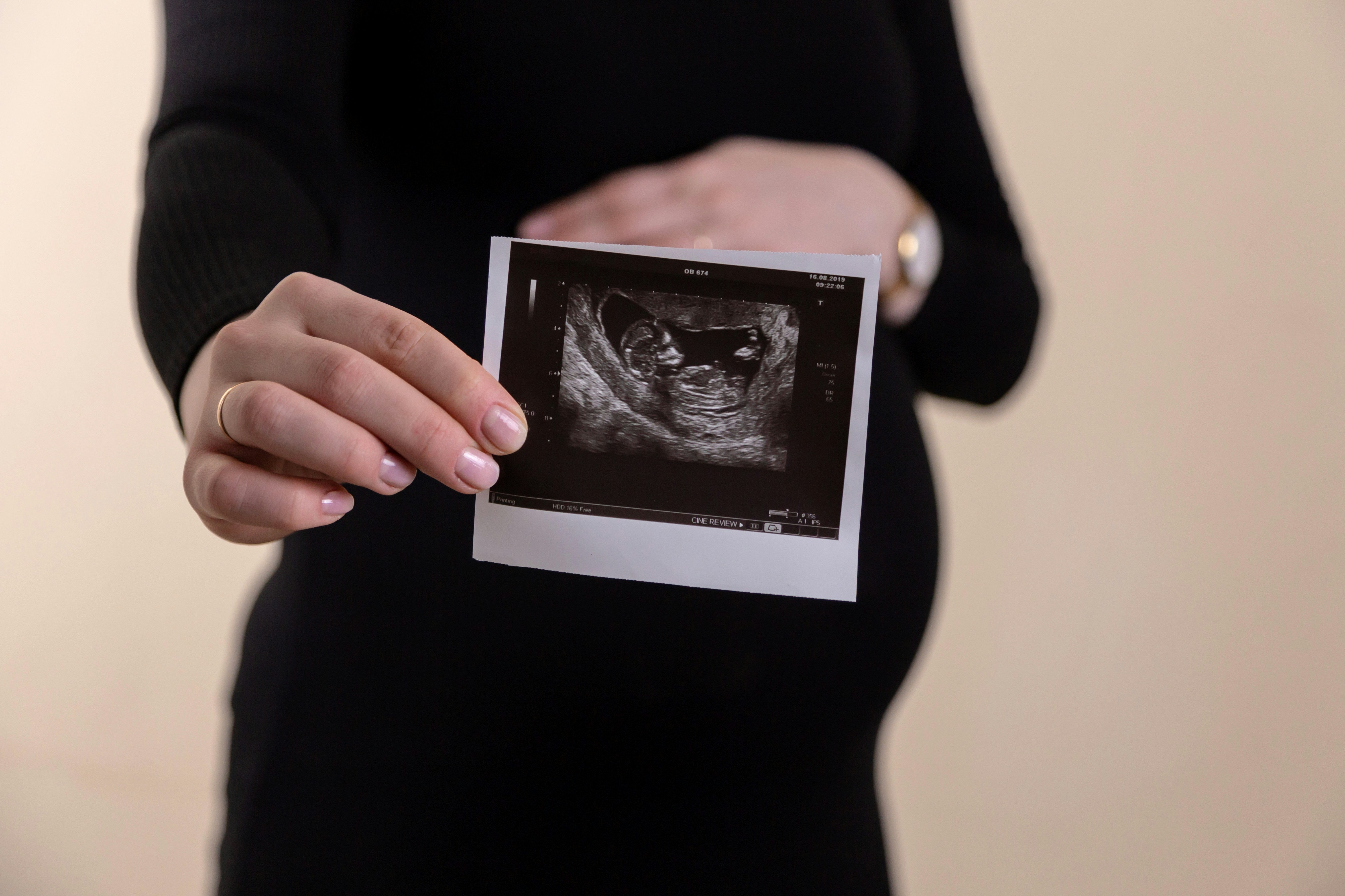 A importância do colágeno no desenvolvimento fetal